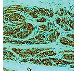 Image of Diagnostic Biosystems MUM1 Protein CONC. Mab MOB 420