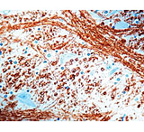 Image of Diagnostic Biosystems Myelin Basic Protn Rabbit .5ML RP 052-05