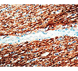 Image of Diagnostic Biosystems Neurofilaments Clone 2F11 .5ML MOB 080-05