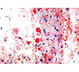 Image of Diagnostic Biosystems Oil Red O Kit 100RXN KT 025