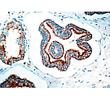 Image of Diagnostic Biosystems P504S Rtu Polyclonal Ab PDR 046