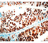 Image of Diagnostic Biosystems P53 Rtu Mab PDM 035