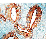 Image of Diagnostic Biosystems Psap CONC. Mab MOB 085