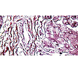 Image of Diagnostic Biosystems Reticulum CHANDLER'S Kt 100RXN KT 031