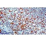 Image of Diagnostic Biosystems CD45RO T Cell CONC. Mab MOB 043