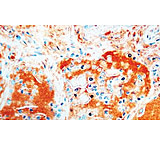 Image of Diagnostic Biosystems Thyroglobulin - Clone 1D4 .5ML MOB 223-05