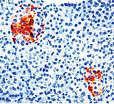 Image of Diagnostic Biosystems TIMP-2 CONC. Mab MOB 318