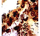 Image of Diagnostic Biosystems WARTHIN-STARRY Kit 100RXN KT 036