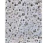 Image of Pall Metricel Pp 0.1UM 47MM PK100 M5PU047