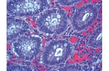 Image of Azer Scientific Formagel 10ml Prefilled Cs128 PFG-20, Unit CS