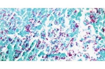 Image of Diagnostic Biosystems A.F.B. Kit 100RXN KT 001