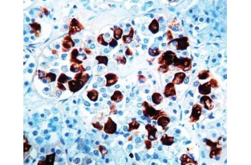 Image of Diagnostic Biosystems Acth Rtu Polyclonal Ab PDR 022