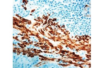 Image of Diagnostic Biosystems Actin Alpha Smooth Muscle Mab MOB 001