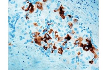 Image of Diagnostic Biosystems Afp - Rabbit .5ML RP 001-05