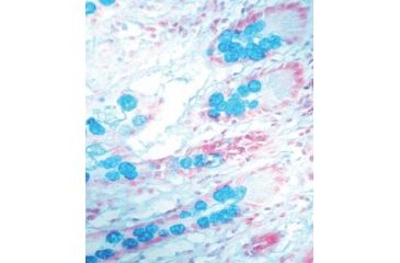Image of Diagnostic Biosystems Alcian BLUE, Ph 1.0 Kit 100RXN KT 002