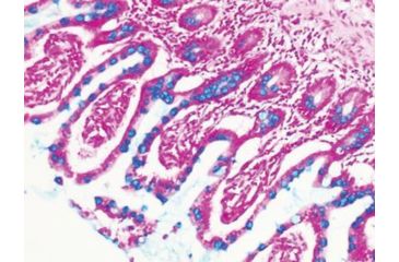 Image of Diagnostic Biosystems Alcian BLUE, Ph 2.5 Kit 100RXN KT 003