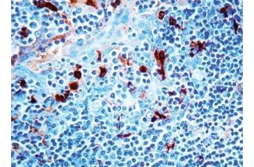 Image of Diagnostic Biosystems ALPHA-1-ANTICHYMOTRYPSIN Rtu PDR 023