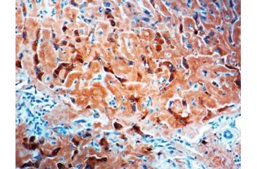 Image of Diagnostic Biosystems Amyloid A Component Rtu Mab PDM 118