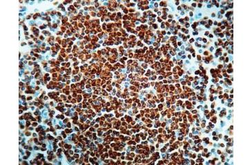 Image of Diagnostic Biosystems BCL-2 Oncoprotein CONC. Mab MOB 130
