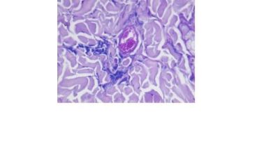 Image of Diagnostic Biosystems C.E.M. Kit 100RXN KT 004
