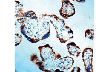 Image of Diagnostic Biosystems Caspase 1 - Rabbit .5ML RP 064-05