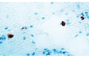 Image of Diagnostic Biosystems Caspase 3 - Clone 3CSP03 .5ML MOB 309-05