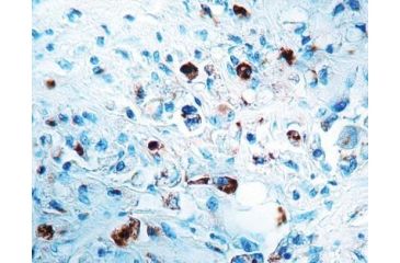 Image of Diagnostic Biosystems Cathepsin D - Rabbit .5ML RP 004-05