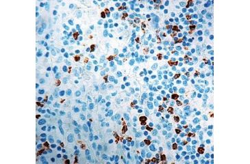 Image of Diagnostic Biosystems CD15 Granulocyte Assoc Antign MOB 365