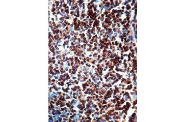 Image of Diagnostic Biosystems CD3 Rtu Mab PDM 126