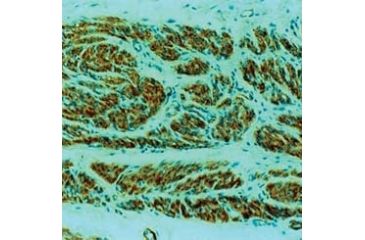 Image of Diagnostic Biosystems CD34 Endothelial Cell Mab MOB 098