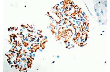 Image of Diagnostic Biosystems CD31 Endothel Cell JC/70A .5ML MOB 034-05