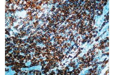 Image of Diagnostic Biosystems CD45 Lca CONC. Mab MOB 040