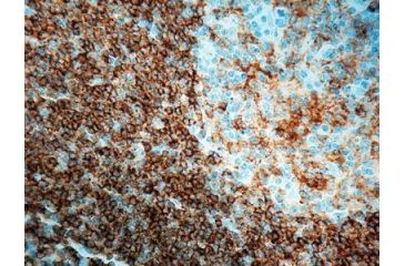 Image of Diagnostic Biosystems CD45RA B Cell Clone 4KB5 .5ML MOB 041-05