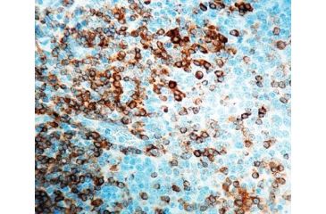 Image of Diagnostic Biosystems CD79A CONC. Polyclonal Ab RP 101