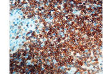 Image of Diagnostic Biosystems CD79A B Cell Cln HM47/A9 .5ML MOB 242-05