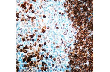 Image of Diagnostic Biosystems CD79A Rtu Rabbit Mab RMPD 014