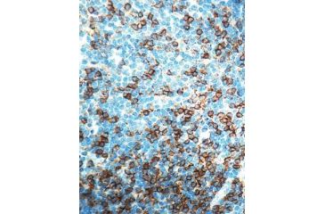 Image of Diagnostic Biosystems CD8 T Cell CONC. Mab MOB117