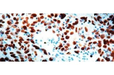 Image of Diagnostic Biosystems CDC47 CONC. Mab MOB 340
