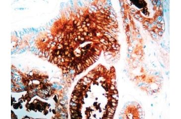 Image of Diagnostic Biosystems Cea - Rabbit .5ML RP 003-05