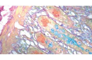 Image of Diagnostic Biosystems Colloidal Iron Kit 100RXN KT 007