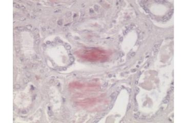 Image of Diagnostic Biosystems Congo Red Kit 100RXN KT 008