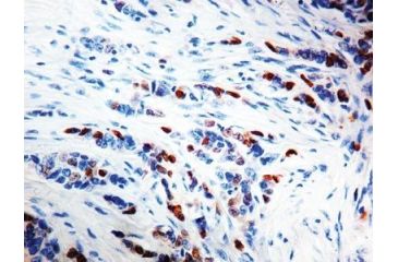 Image of Diagnostic Biosystems Cyclin D1 Clone BV2 RMPD 023