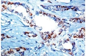 Image of Diagnostic Biosystems Cyclin D1 - Clone DCS-6 .5ML MOB 178-05