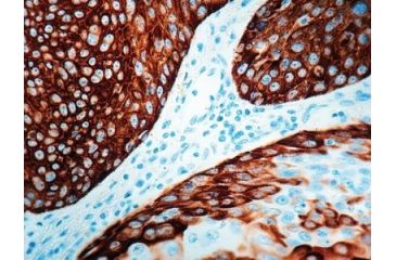 Image of Diagnostic Biosystems Cytokeratin 14 CONC. Mab MOB 186