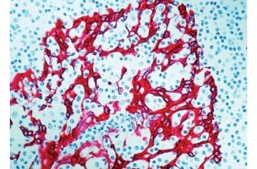 Image of Diagnostic Biosystems Cytokeratin H.M.W. DE-SQ .5ML MOB 275-05