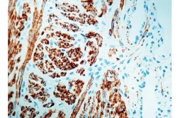 Image of Diagnostic Biosystems Desmin CONC. Polyclonal Ab RP 011