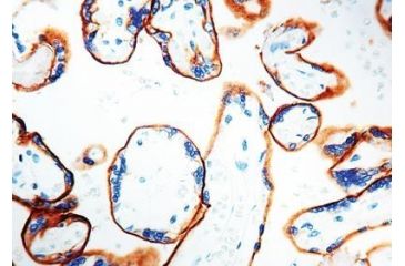 Image of Diagnostic Biosystems Egfr - Clone SP9 1ML RMAB 020