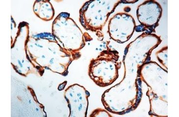 Image of Diagnostic Biosystems Egfr CONC. Mab MOB 267