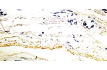 Image of Diagnostic Biosystems Elastin - Clone BA-4 .5ML MOB 230-05