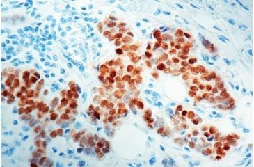 Image of Diagnostic Biosystems Estrogen Receptor Rabbit .5ML RP 141-05